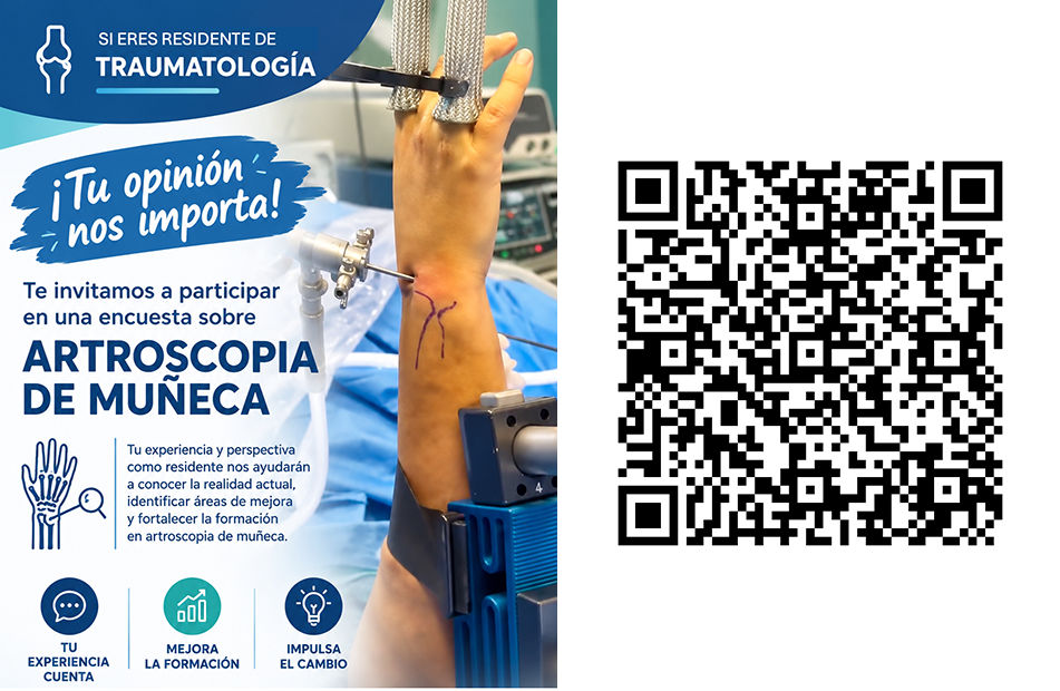 Estudio para pacientes con Tumores de Células Gigantes Tenosinoviales (TCGT)