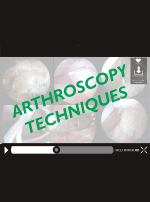 Arthroscopy Techniques – Sciencedirect