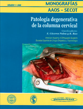 Patología degenerativa de la columna cervical