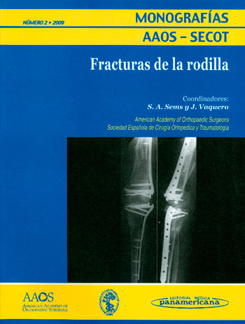 Fracturas de rodilla