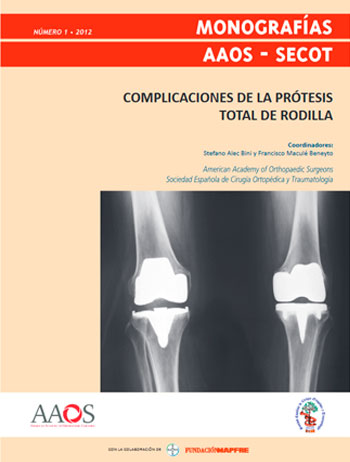 Complicaciones de la prótesis total de rodilla